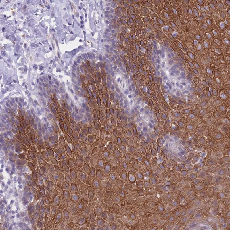 Immunohistochemical staining of human esophagus shows strong cytoplasmic positivity in squamous epithelial cells.