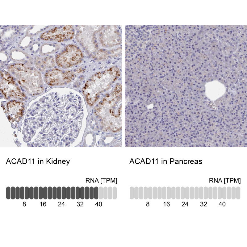 Immunohistochemistry analysis in human kidney and pancreas tissues using HPA048317 antibody. Corresponding ACAD11 RNA-seq data are presented for the same tissues.