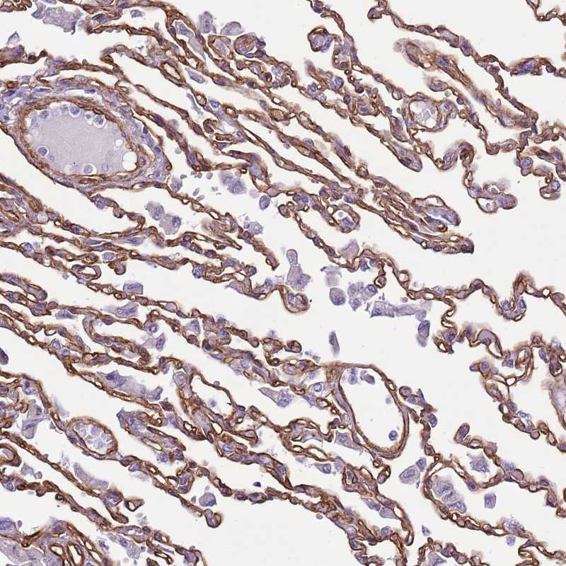 Immunohistochemical staining of human lung shows moderate membranous positivity in pneumocytes.