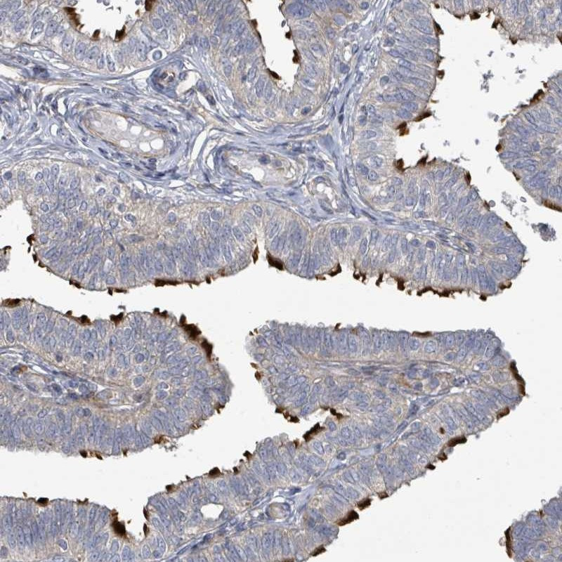 Immunohistochemical staining of human fallopian tube shows distinct positivity in cilia.