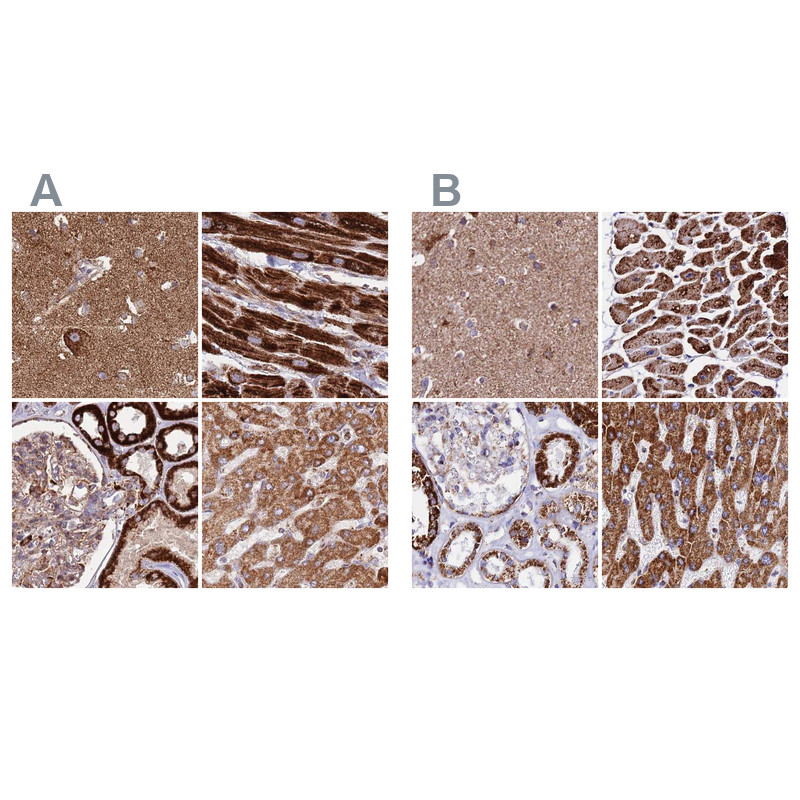 Immunohistochemical staining of human cerebral cortex, heart muscle, kidney and liver using Anti-ATP5H antibody HPA048459 (A) shows similar protein distribution across tissues to independent antibody HPA042777 (B).