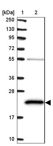 Lane 1: Marker [kDa] 250, 130, 95, 72, 55, 36, 28, 17, 10<br/>Lane 2: Human cell line RT-4