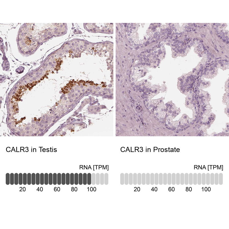 Immunohistochemistry analysis in human testis and endometrium tissues using Anti-CALR3 antibody. Corresponding CALR3 RNA-seq data are presented for the same tissues.