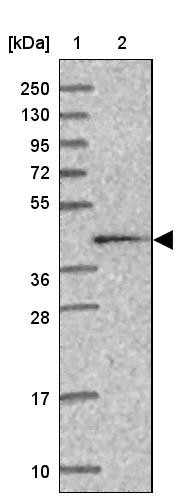 Lane 1: Marker [kDa] 250, 130, 95, 72, 55, 36, 28, 17, 10<br/>Lane 2: Human cell line RT-4