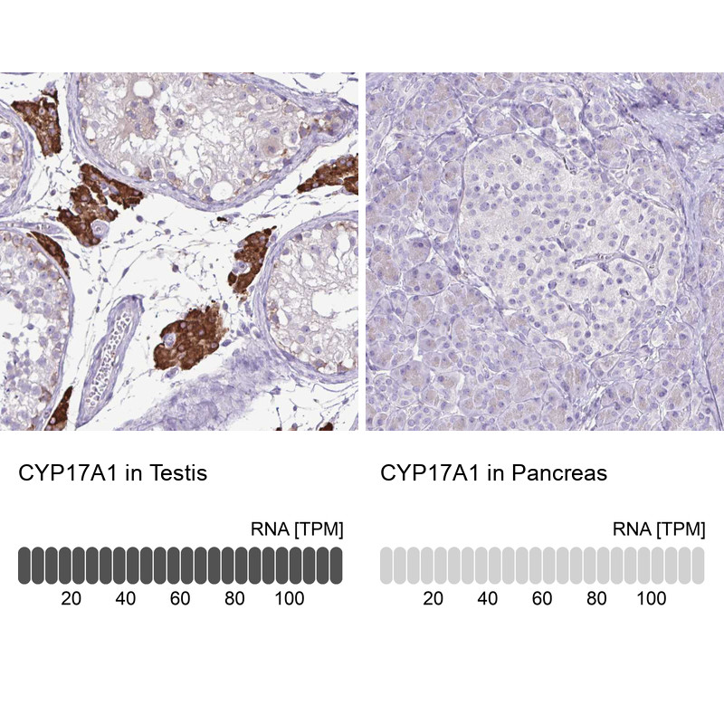 Immunohistochemistry analysis in human testis and pancreas tissues using HPA048533 antibody. Corresponding CYP17A1 RNA-seq data are presented for the same tissues.