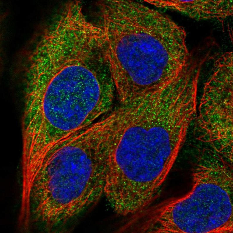 Immunofluorescent staining of human cell line A-431 shows localization to cytosol.
