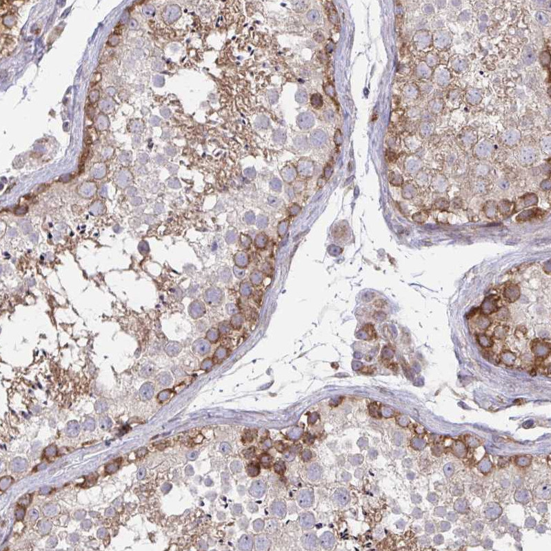 Immunohistochemical staining of human bone marrow shows strong cytoplasmic positivity in hematopoietic cells.