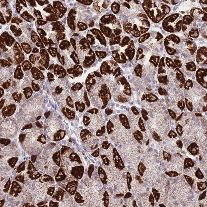 Immunohistochemical staining of human stomach, lower shows strong cytoplasmic positivity in subset of glandular cells.