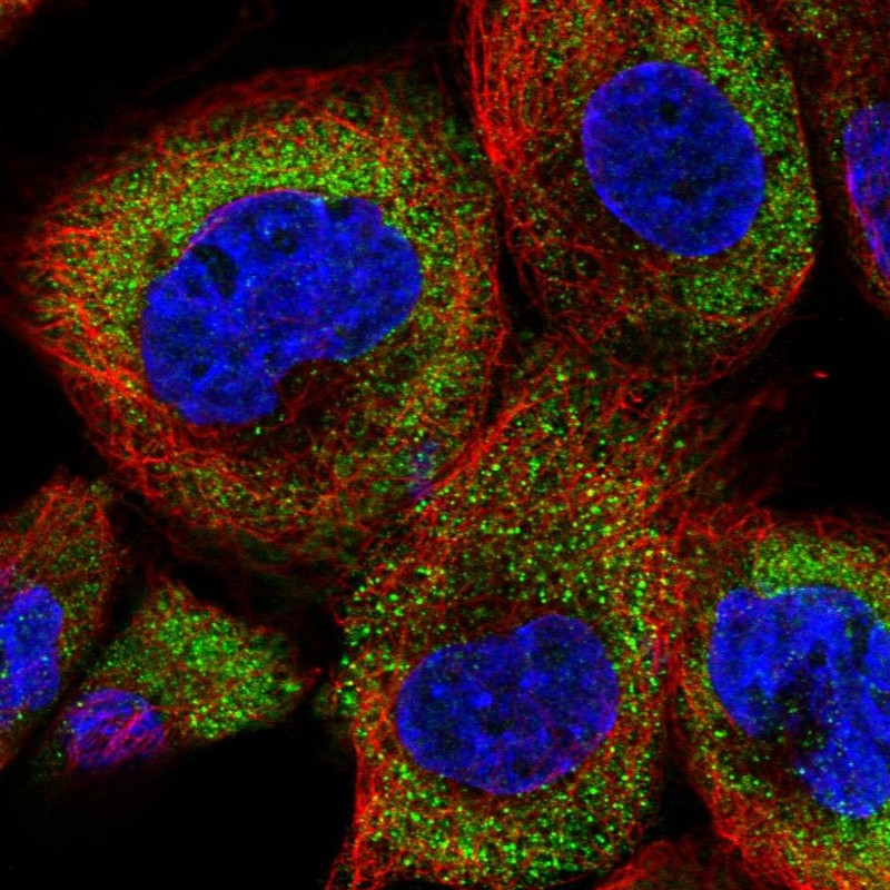 Immunofluorescent staining of human cell line A-431 shows localization to cytosol.