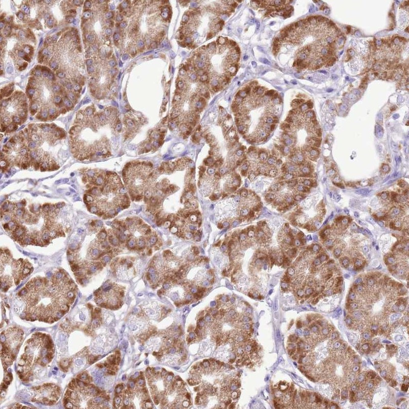 Immunohistochemical staining of human stomach, lower shows strong cytoplasmic positivity in glandular cells.