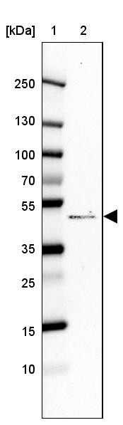 Lane 1: Marker [kDa] 250, 130, 100, 70, 55, 35, 25, 15, 10<br/>Lane 2: Human cell line CACO-2