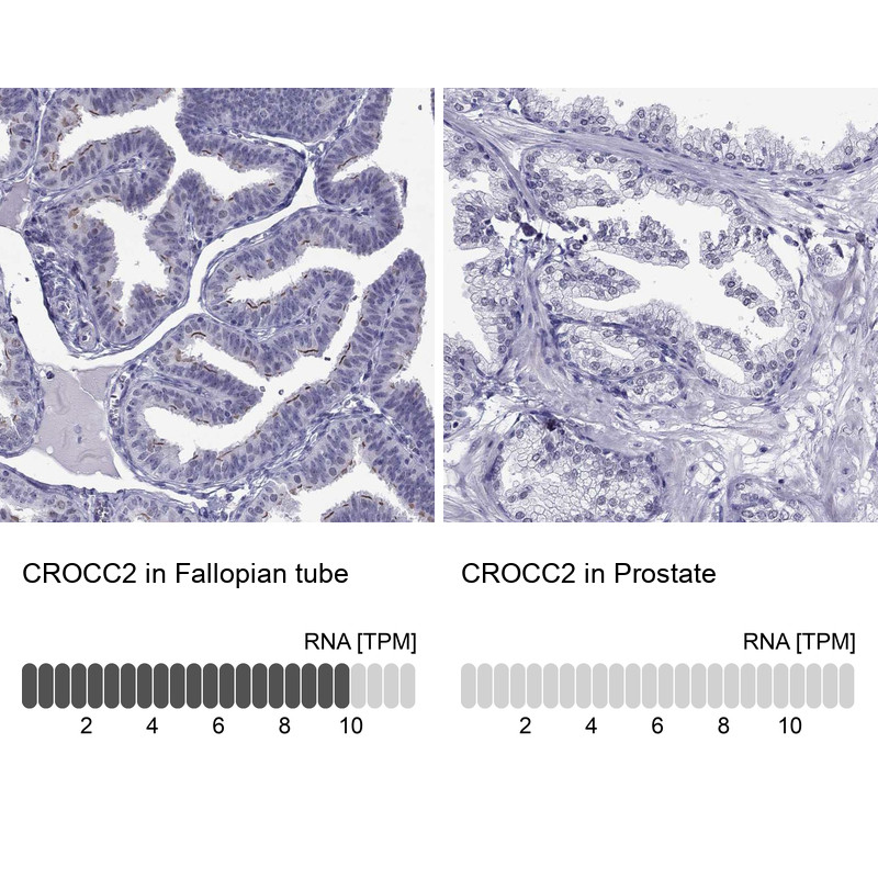 Immunohistochemistry analysis in human fallopian tube and prostate tissues using Anti-CROCC2 antibody. Corresponding CROCC2 RNA-seq data are presented for the same tissues.