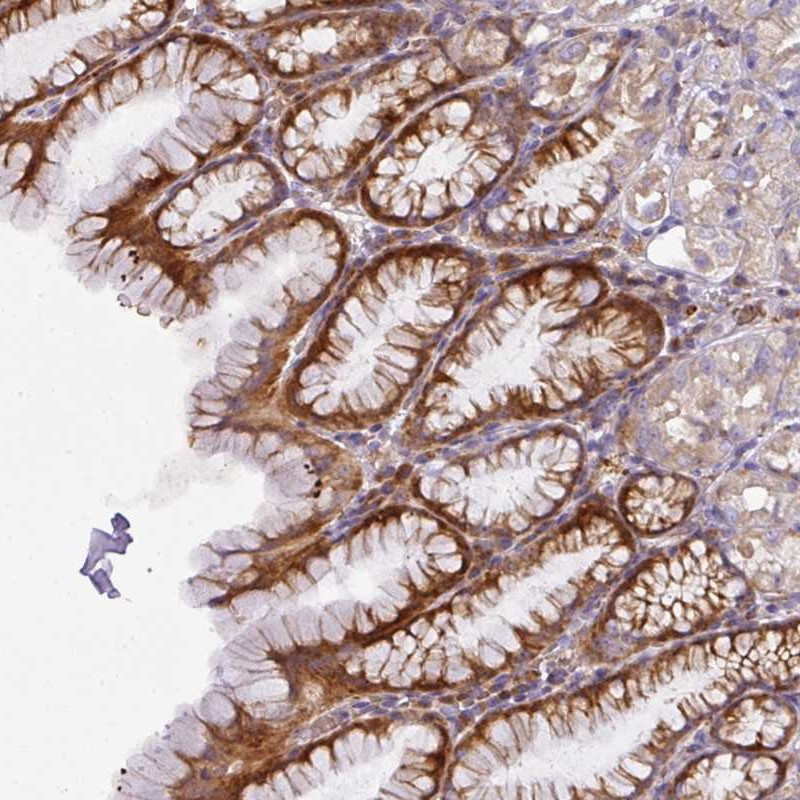 Immunohistochemical staining of human stomach, upper shows strong cytoplasmic positivity in glandular cells.