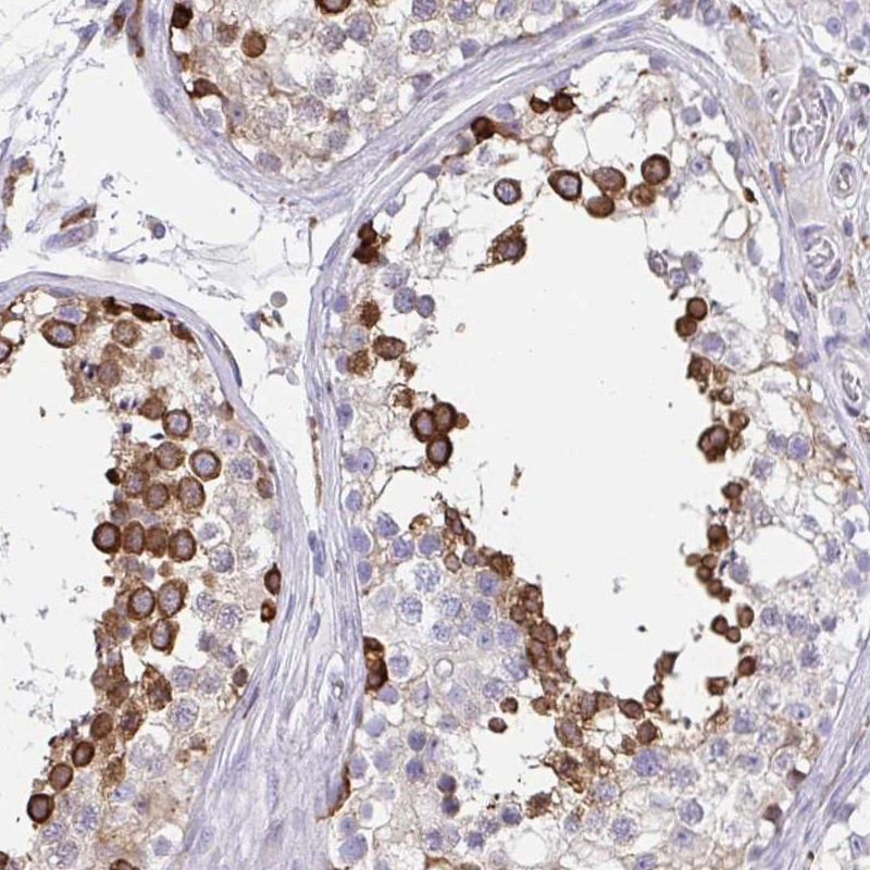 Immunohistochemical staining of human testis shows strong cytoplasmic positivity in subset of cells in seminiferus ducts.