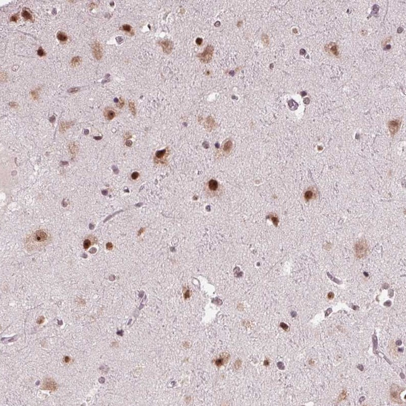 Immunohistochemical staining of human cerebral cortex shows strong nuclear positivity in neuronal cells.