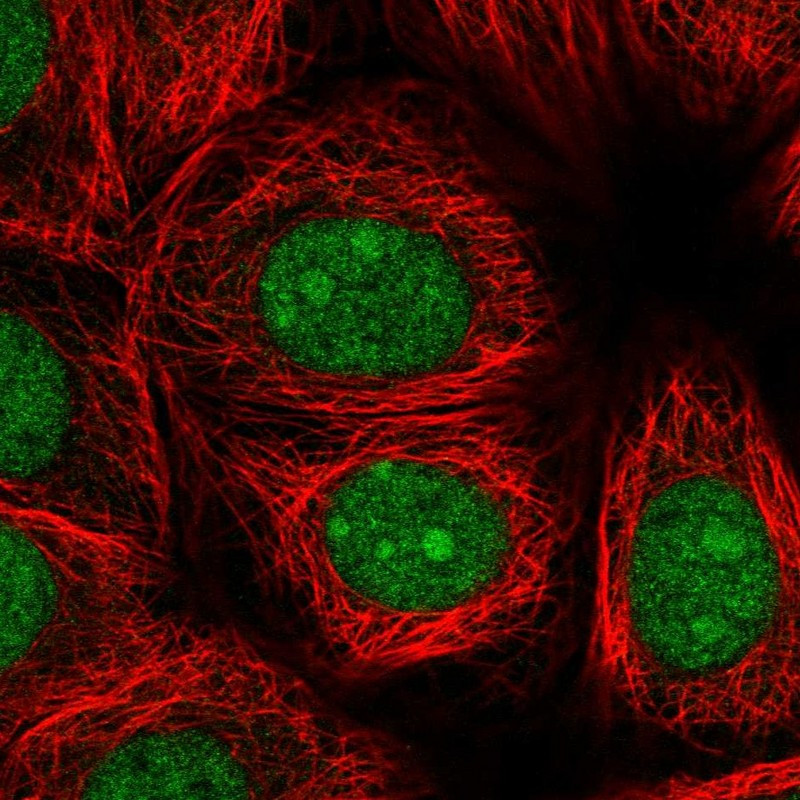 Immunofluorescent staining of human cell line MCF7 shows localization to nucleus & nucleoli.