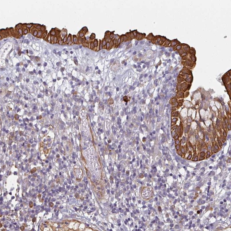 Immunohistochemical staining of human nasopharynx shows strong cytoplasmic positivity in respiratory epithelial cells.