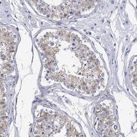 Immunohistochemical staining of human testis shows moderate cytoplasmic positivity in cells in seminiferous ducts.