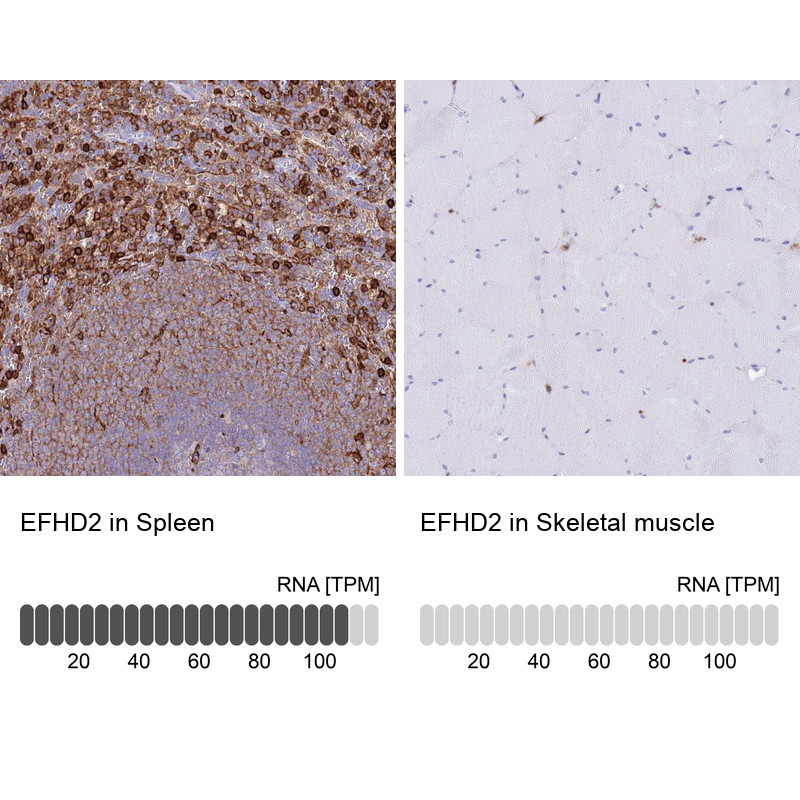 Immunohistochemistry analysis in human spleen and skeletal muscle tissues using Anti-EFHD2 antibody. Corresponding EFHD2 RNA-seq data are presented for the same tissues.
