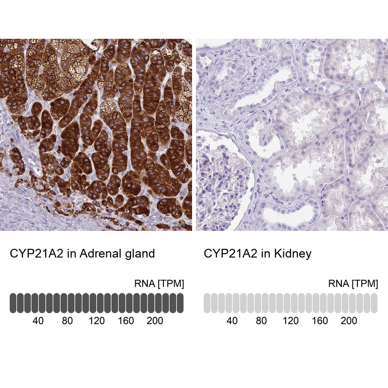 Immunohistochemistry analysis in human adrenal gland and kidney tissues using HPA048979 antibody. Corresponding CYP21A2 RNA-seq data are presented for the same tissues.
