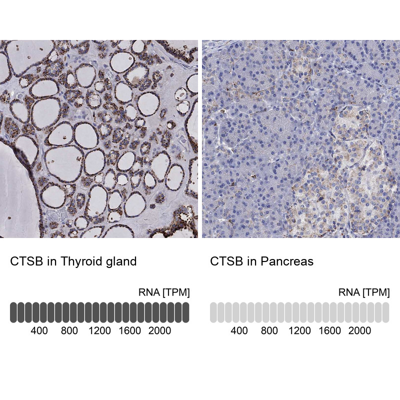 Immunohistochemistry analysis in human thyroid gland and pancreas tissues using Anti-CTSB antibody. Corresponding CTSB RNA-seq data are presented for the same tissues.