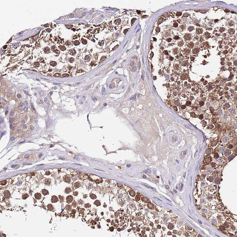 Immunohistochemical staining of human testis shows moderate nuclear positivity in cells in seminiferous ducts.