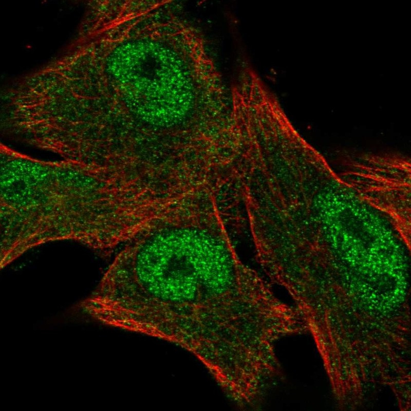 Immunofluorescent staining of human cell line SK-MEL-30 shows localization to nucleoplasm & cytosol.