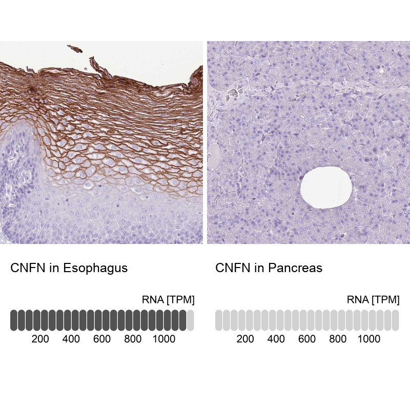 Immunohistochemistry analysis in human esophagus and pancreas tissues using Anti-CNFN antibody. Corresponding CNFN RNA-seq data are presented for the same tissues.