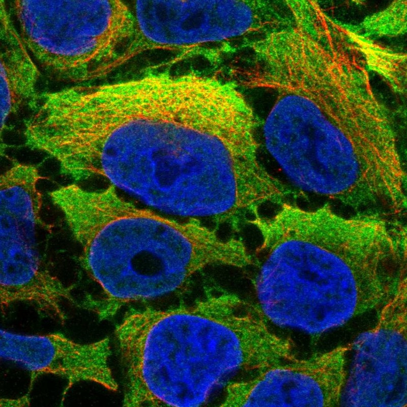 Immunofluorescent staining of human cell line CACO-2 shows localization to cytosol.