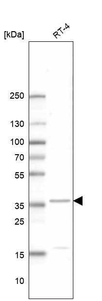 Lane 1: Marker [kDa] 250, 130, 95, 72, 55, 36, 28, 17, 10<br/>Lane 2: Human cell line RT-4<br/>Lane 3: Human cell line U-251MG sp