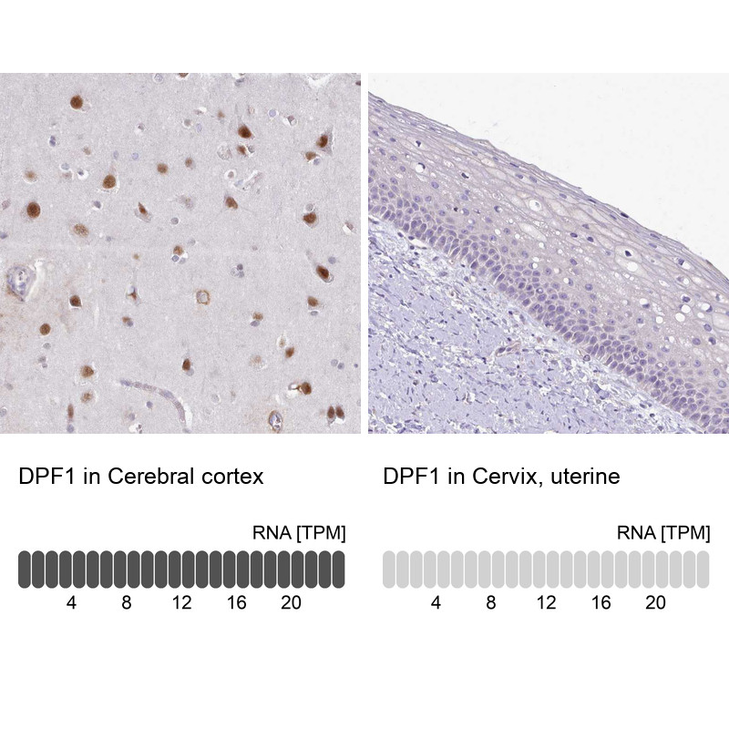 Immunohistochemistry analysis in human cerebral cortex and cervix, uterine tissues using HPA049148 antibody. Corresponding DPF1 RNA-seq data are presented for the same tissues.
