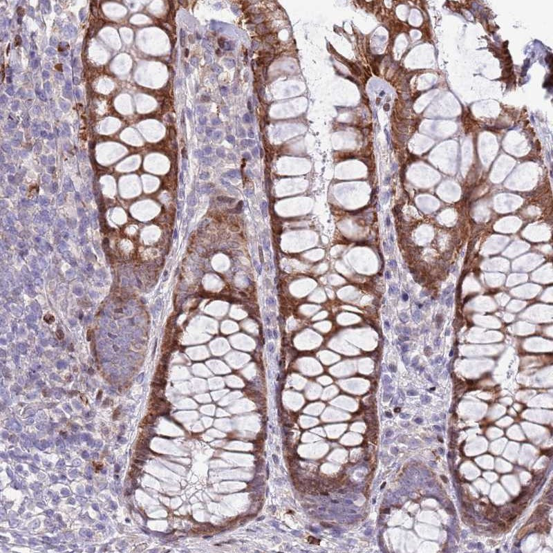 Immunohistochemical staining of human rectum shows strong cytoplasmic positivity in glandular cells.