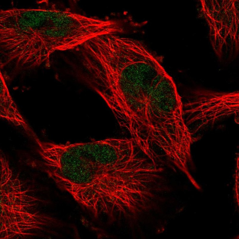 Immunofluorescent staining of human cell line U-251 MG shows localization to nucleoplasm.