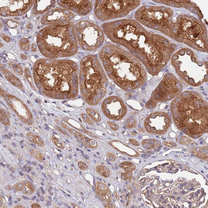 Immunohistochemical staining of human kidney shows strong cytoplasmic positivity in renal tubules.