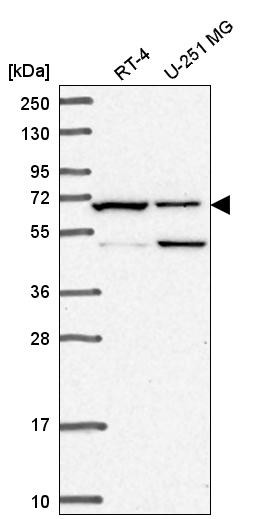 Western blot analysis in human cell line RT-4 and human cell line U-251 MG.