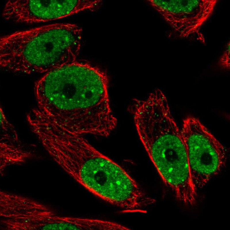 Immunofluorescent staining of human cell line PC-3 shows localization to nucleoplasm & nuclear bodies.