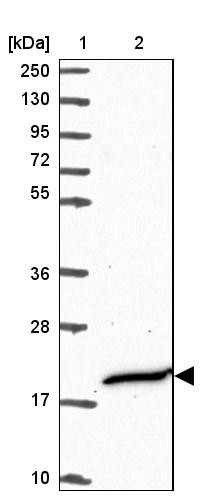 Lane 1: Marker [kDa] 250, 130, 95, 72, 55, 36, 28, 17, 10<br/>Lane 2: Human cell line RT-4