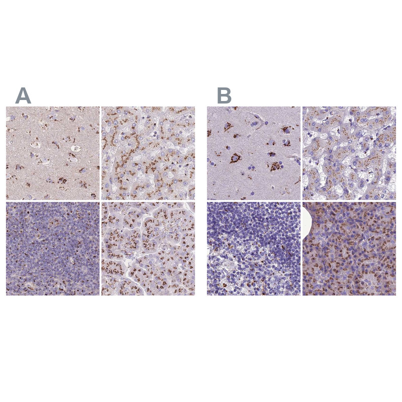 Immunohistochemical staining of human cerebral cortex, liver, lymph node and pancreas using Anti-CASC4 antibody HPA049488 (A) shows similar protein distribution across tissues to independent antibody HPA043015 (B).