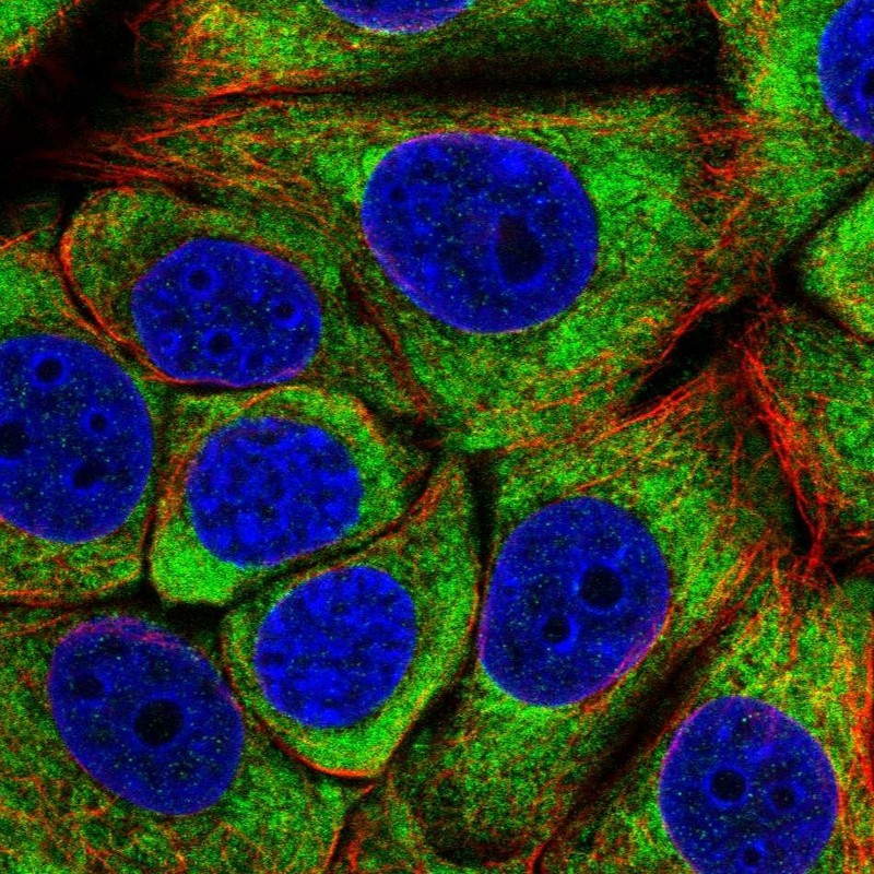 Immunofluorescent staining of human cell line MCF7 shows localization to cytosol.
