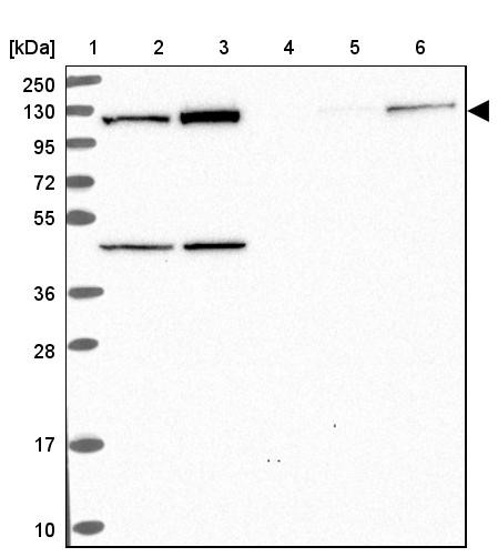 Lane 1: Marker [kDa] 250, 130, 95, 72, 55, 36, 28, 17, 10<br/>Lane 2: Human cell line RT-4<br/>Lane 3: Human cell line U-251 MG<br/>Lane 4: Human plasma<br/>Lane 5: Human Liver tissue<br/>Lane 6: Human Tonsil tissue
