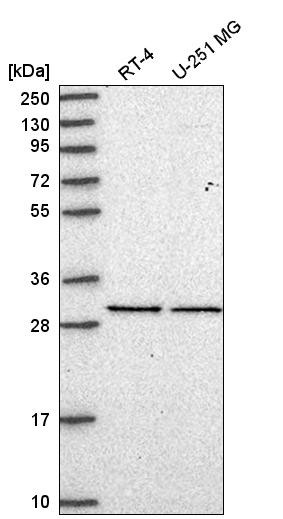 Western blot analysis in human cell line RT-4 and human cell line U-251 MG.