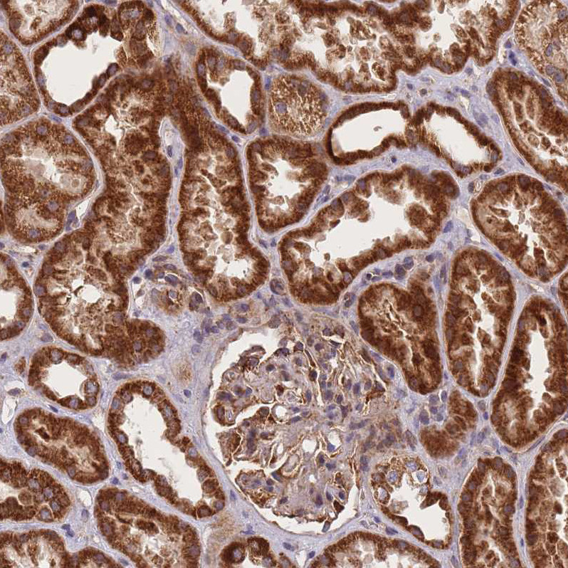 Immunohistochemical staining of human kidney shows strong granular cytoplasmic positivity in cells in tubules.