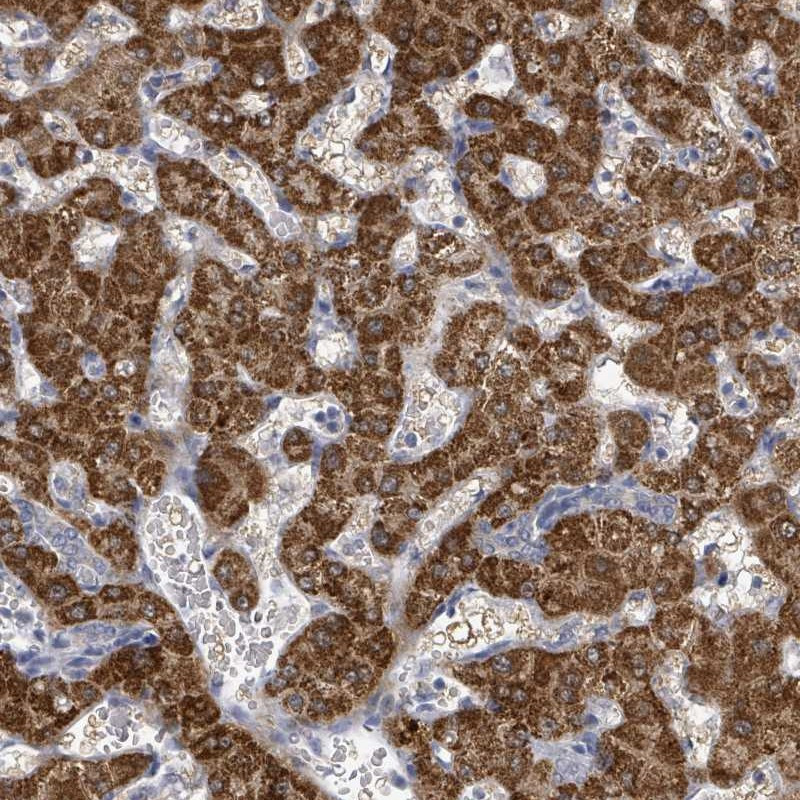 Immunohistochemical staining of human liver shows strong cytoplasmic positivity in hepatocytes.