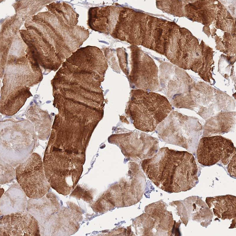 Immunohistochemical staining of human skeletal muscle shows strong cytoplasmic positivity in myocytes.