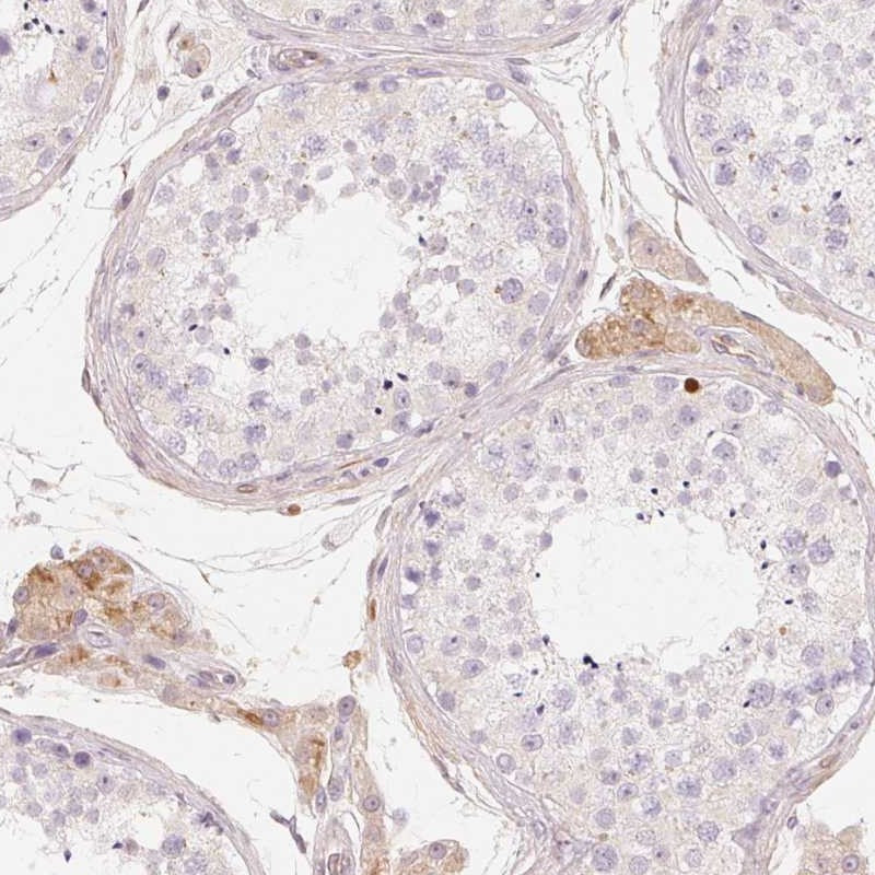 Immunohistochemical staining of human testis shows moderate cytoplasmic positivity in Leydig cells.