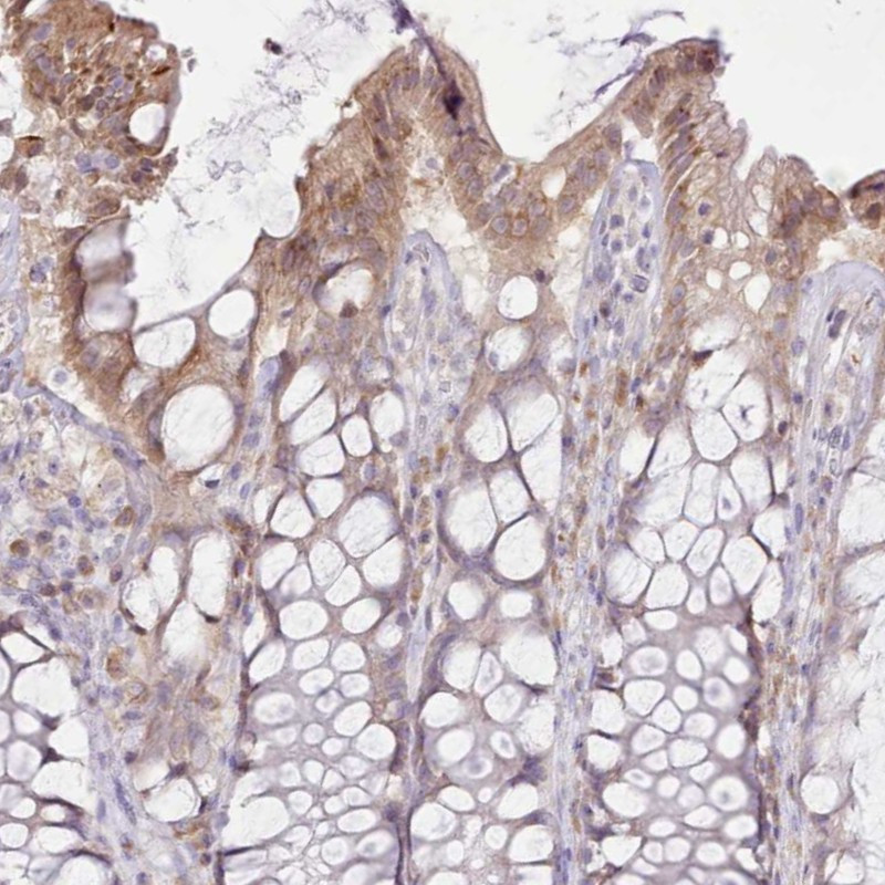 Immunohistochemical staining of human rectum shows moderate cytoplasmic positivity in glandular cells.