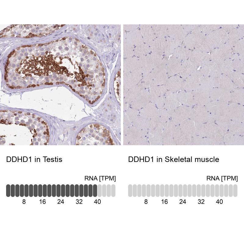 Immunohistochemistry analysis in human testis and skeletal muscle tissues using HPA049870 antibody. Corresponding DDHD1 RNA-seq data are presented for the same tissues.