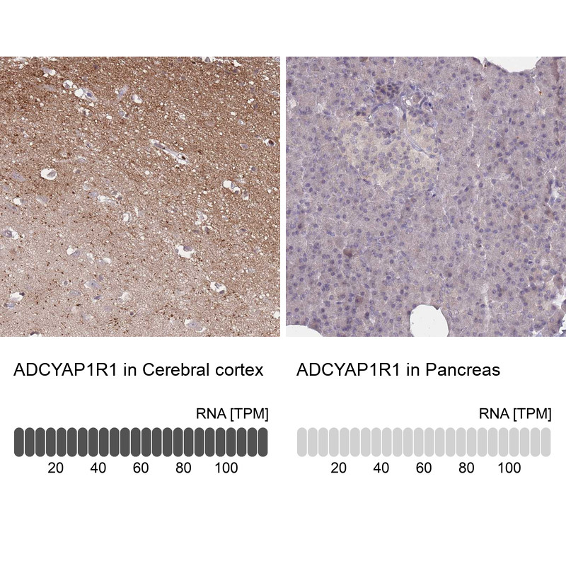 Immunohistochemistry analysis in human cerebral cortex and pancreas tissues using Anti-ADCYAP1R1 antibody. Corresponding ADCYAP1R1 RNA-seq data are presented for the same tissues.