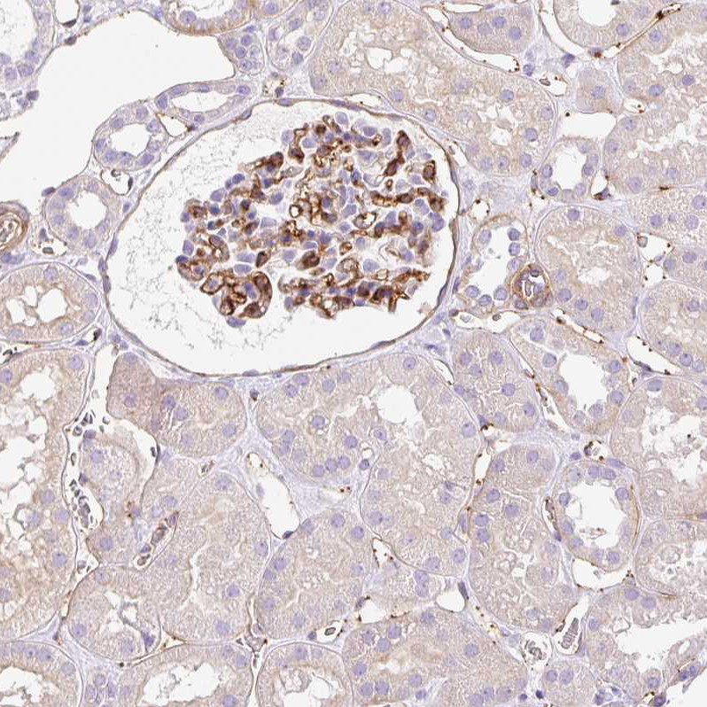 Immunohistochemical staining of human kidney shows strong membranous positivity in cells in glomeruli.