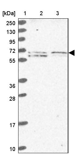 Lane 1: Marker [kDa] 250, 130, 95, 72, 55, 36, 28, 17, 10<br/>Lane 2: Human cell line RT-4<br/>Lane 3: Human cell line U-251MG sp